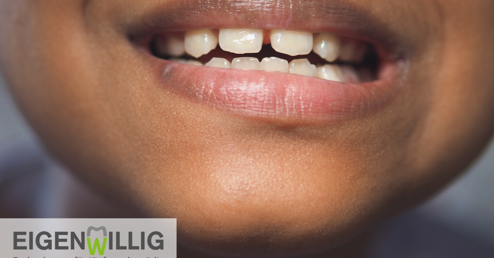 Zahnlücken schließen