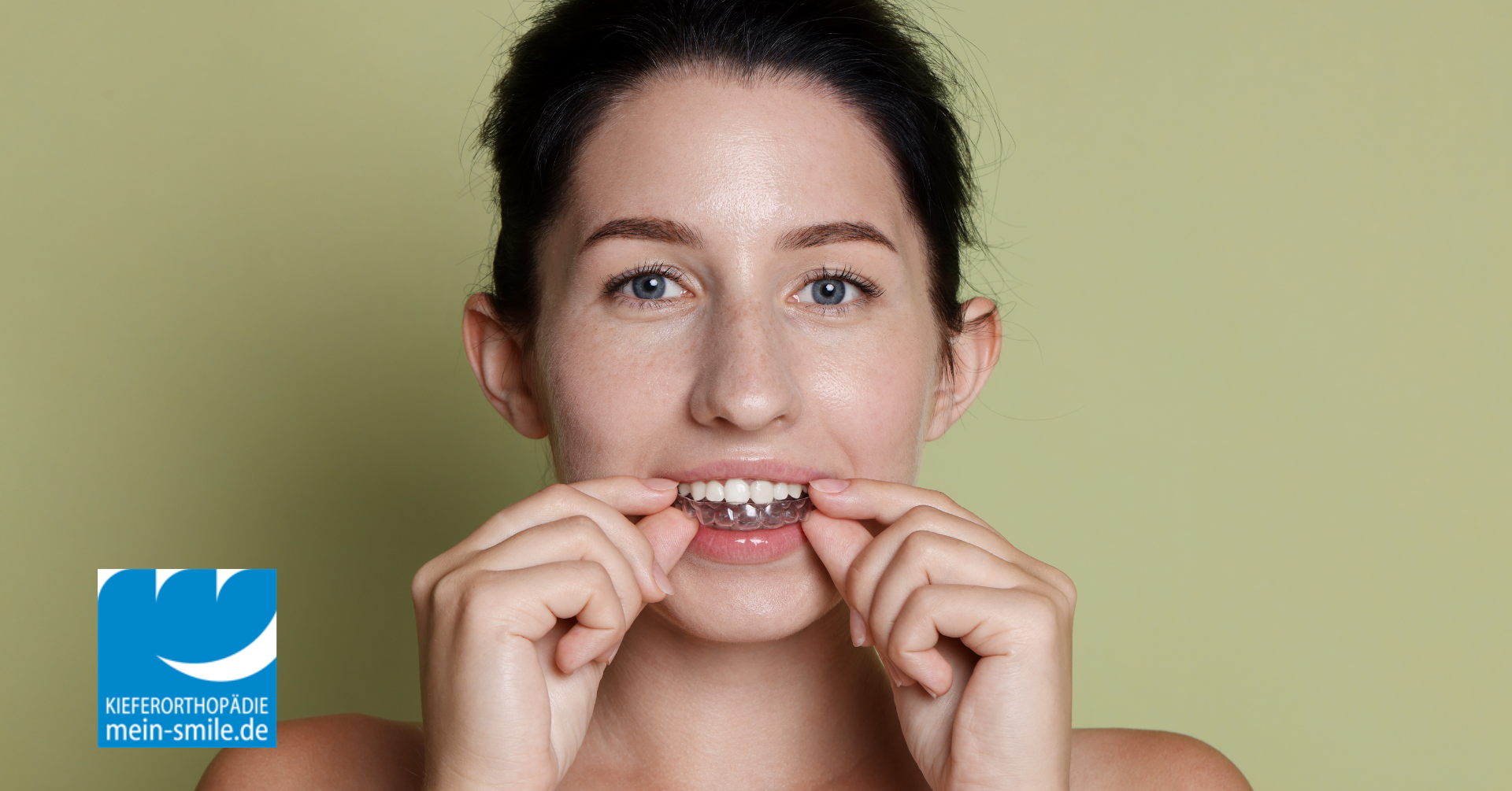 Aligner vs. Zahnspange