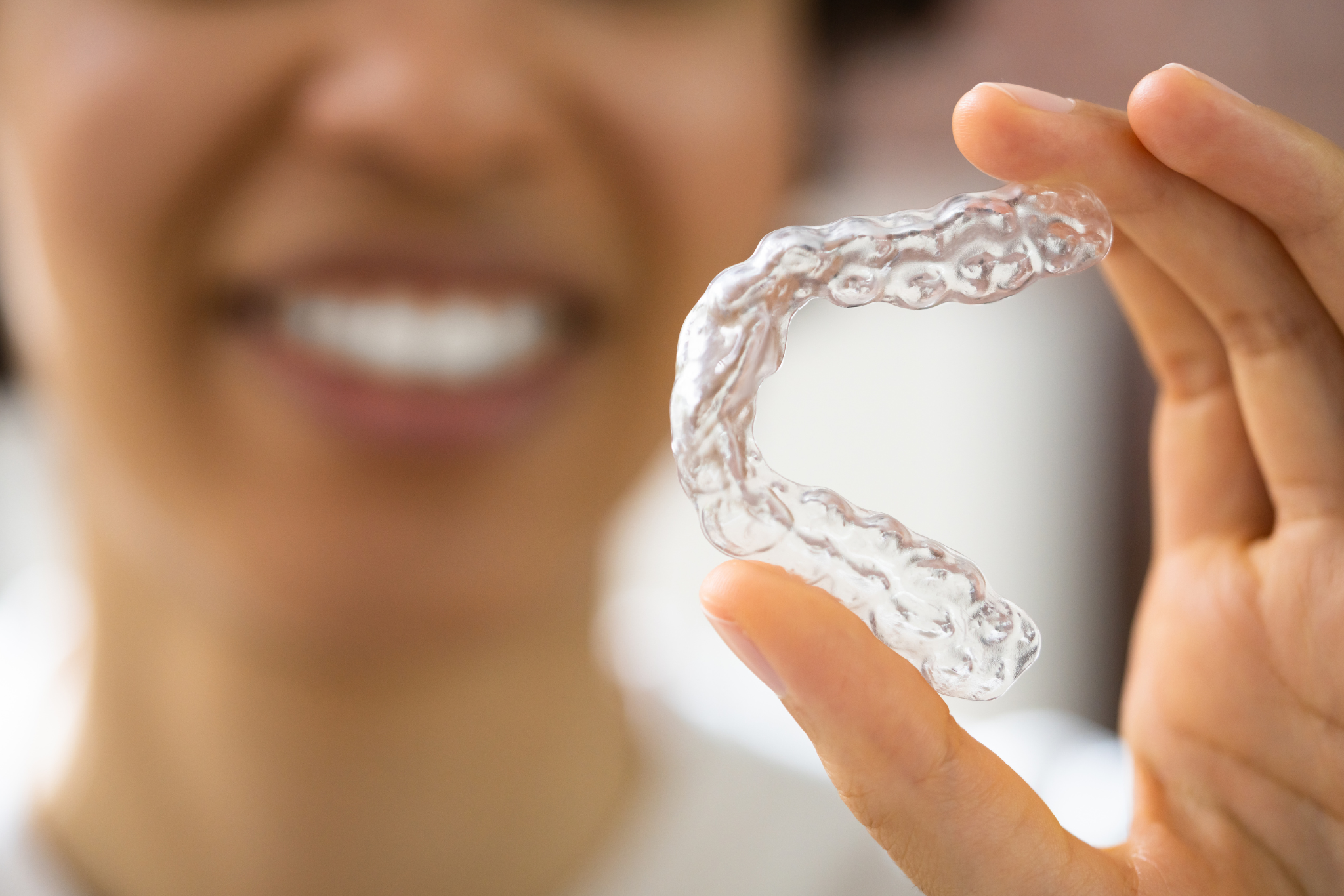 Aligner Aligner