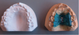 Bioplate
