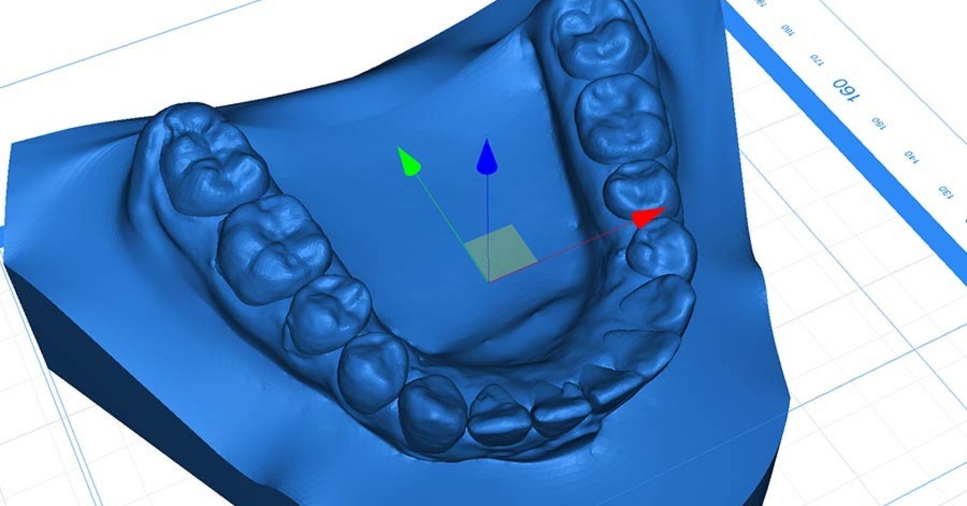 Virtuelle Behandlungsplanung Virtuelle Behandlungsplanung in der Kieferorthopädie